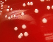 staphylococcus epidermidis